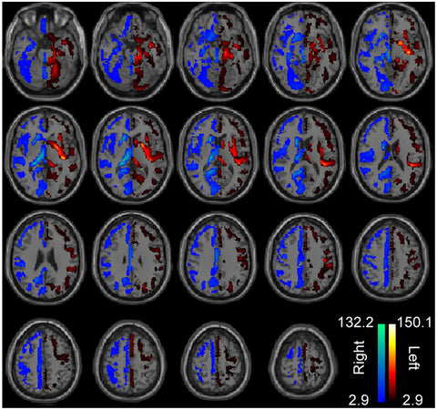 Maximizing Brain Health: Neuroplasticity Nutrition